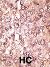 IHC-P - ATG5 Antibody (C-term) AP1812b