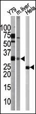WB - ATG5 Antibody (C-term) AP1812b