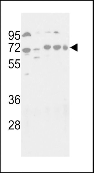 Western blot analysis of hAPG16L-K366 (Cat.#AP1817c) in NIH-3T3, HepG2, Hela, Jurkat and NCI-H460 cell line lysates (35ug/lane). APG16L (arrow) was detected using the purified Pab.