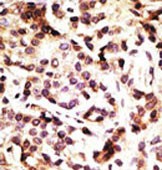 IHC-P - Beclin 1 Antibody AP1818a
