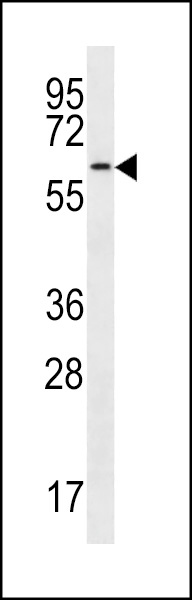 His6-cdc14 Antibody (Cat. #AP8440a) western blot analysis in HepG2 cell line lysates (35ug/lane).This demonstrates the cdc14 antibody detected the cdc14 protein (arrow).