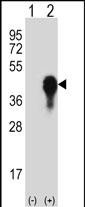 Western blot analysis of MKP3 (arrow) using rabbit polyclonal MKP3-His6 Antibody (Cat. #AP8445a). 293 cell lysates (2 ug/lane) either nontransfected (Lane 1) or transiently transfected (Lane 2) with the MKP3 gene.
