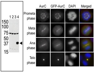 The anti-Aurora C Pab (Cat. #AP7000e) is used in Western blot to detect Aurora C in lysates of 293 cells expressing Flag tag (lane 1), Flag-tagged Aurora A (lane 2), Flag-tagged Aurora B (lane 3) or Flag-tagged Aurora C (lane 4). In the immunofluorescence experiment, staining of HeLa cells expressing GFP-Aurora C is performed at different cellular mitotic stages with the anti-Aurora C Pab as primary antibody (column A), GFP fluorescence (column B), DAPI nuclear staining (column C), and anti-Aurora C merged to DAPI staining (column D). Data is kindly provided by Drs. K. Sasai and S. Sen from the University of Texas MD Anderson Cancer Center (Houston, TX).