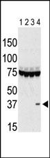 The anti-Aurora C Pab (Cat. #AP7000g) is used in Western blot to detect Aurora C in lysates of 293 cells expressing Flag tag (lane 1), Flag-tagged Aurora A (lane 2), Flag-tagged Aurora B (lane 3), and Flag-tagged Aurora C (lane 4). Data is kindly provided by Drs. K. Sasai and S. Sen from the University of Texas MD Anderson Cancer Center (Houston, TX).