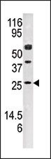 Western blot analysis of anti-AK3 Pab (Cat. #AP8132c) in mouse kidney tissue lysate (35ug/lane). AK3(arrow) was detected using the purified Pab.