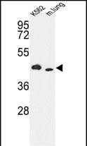 Western blot analysis of hITPKA-E360 (Cat.# AP8166b) in K562 cell line and mouse lung tissue lysates (35ug/lane). ITPKA (arrow) was detected using the purified Pab.