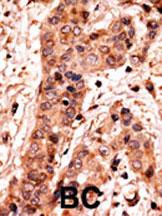 IHC-P - Guanylyl Cyclase alpha 2 (GUCY1A2) Antibody (C-term) AP8176b