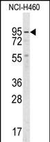 WB - Guanylyl Cyclase alpha 2 (GUCY1A2) Antibody (C-term) AP8176b