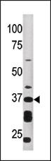 Western blot analysis of anti-ART1 Pab (Cat. #AP2311c) in HepG2 cell line lysate (35ug/lane). ART1(arrow) was detected using the purified Pab.