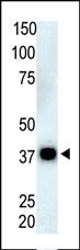 The anti-PPP6C Pab (Cat. #AP8477a) is used in Western blot to detect PPP6C in Thymus cell lysate.