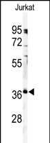 Western blot analysis of anti-PPP6C Antibody (C-term) (Cat.#AP8477b) in Jurkat cell line lysates (35ug/lane). PPP6C(arrow) was detected using the purified Pab.