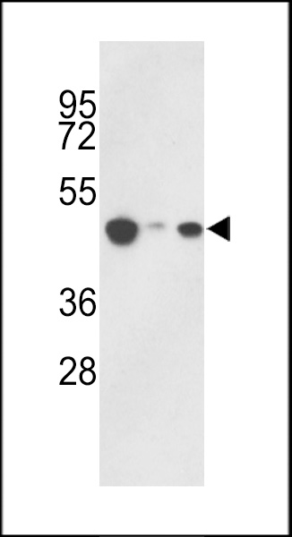 Western blot analysis of hHAT1-E404 (Cat. #AP1079b) in 293, HepG2, Jurkat cell line lysates (35ug/lane). HAT1 (arrow) was detected using the purified Pab.