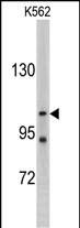 Western blot analysis of LLGL2 antibody (C-term) (Cat. #AP2199a) in K562 cell line lysates (35ug/lane). LLGL2 (arrow) was detected using the purified Pab.