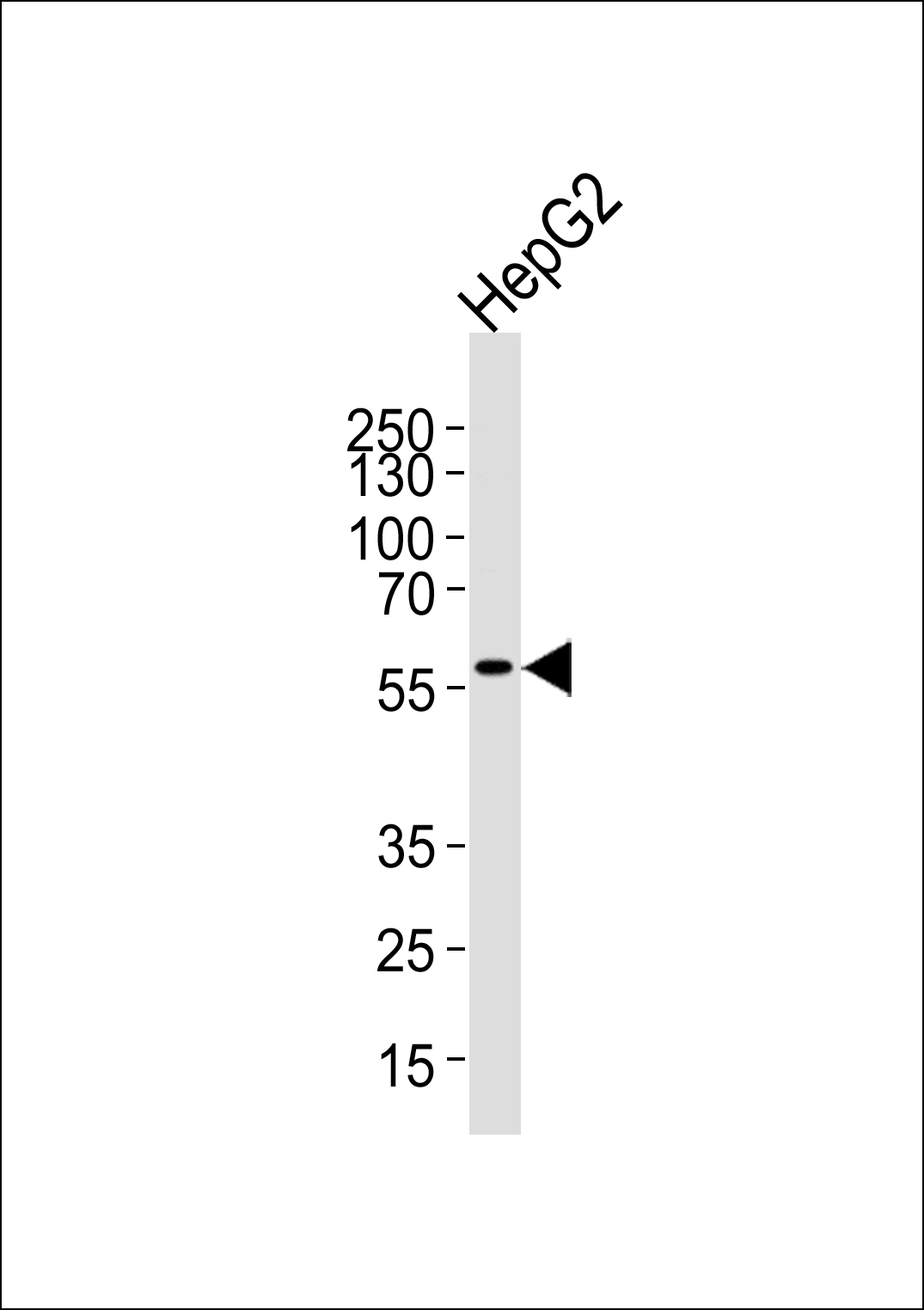 Western blot analysis of lysate from HepG2 cell line, using MLLT3 C-term Antibody(Cat. #AP6190b). AP6190b was diluted at 1:1000 at each lane. A goat anti-rabbit IgG H&L(HRP) at 1:5000 dilution was used as the secondary antibody. Lysate at 35ug per lane. 