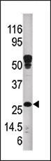 Western blot analysis of anti-ABAD Pab (Cat. #AP6307b) in mouse kidney tissue lysate.ABAD(arrow) was detected using the purified Pab.