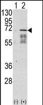 Western blot analysis of ACVR1 (arrow) using rabbit polyclonal ACVR1 Antibody (Center N153) (Cat.#AP7101a). 293 cell lysates (2 ug/lane) either nontransfected (Lane 1) or transiently transfected with the ACVR1 gene (Lane 2) (Origene Technologies).