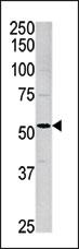 Western blot analysis of anti-ACVR1 Pab (Cat. #AP7101c) in mouse brain tissue lysate. ACVR1(arrow) was detected using the purified Pab.