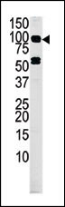 Western blot analysis of anti-MARK4 Pab (Cat.#AP7145b) in mouse  liver tissue lysate (35ug/lane). MARK4(arrow) was detected using the purified Pab.