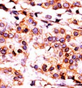 IHC-P - PANK1 Antibody (Center) AP7159b
