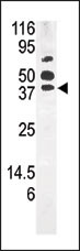 WB - PANK1 Antibody (Center) AP7159b