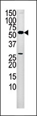 WB - PANK2 Antibody (Center) AP7160b