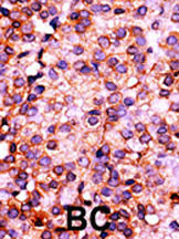 IHC-P - PANK3 Antibody (N-term) AP7161a