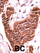 IHC-P - STK29 Antibody (C-term) AP7191B