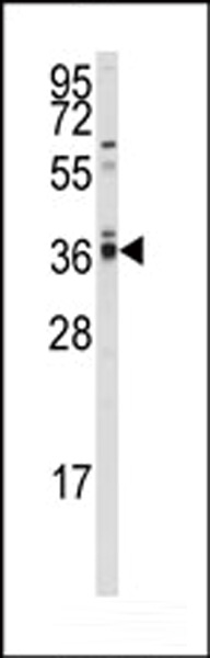 Western blot analysis of anti-hPPP2CA/B Antibody (N-term) (Cat.#AP8462a) in A2058 cell line lysates (35ug/lane). PPP2CA/B (arrow) was detected using the purified Pab.