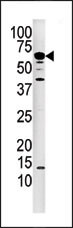 Western blot analysis of anti-PPP3CA Pab (Cat. #AP8463a) in mouse kidney tissue lysate.PPP3CA(arrow) was detected using the purified Pab.