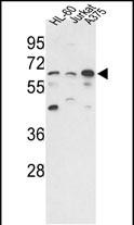 Western blot analysis of hPPP3CC-E33 (Cat. #AP8465a) in HL-60, Jurkat, A375 cell line lysates (35ug/lane). PPP3CC (arrow) was detected using the purified Pab.