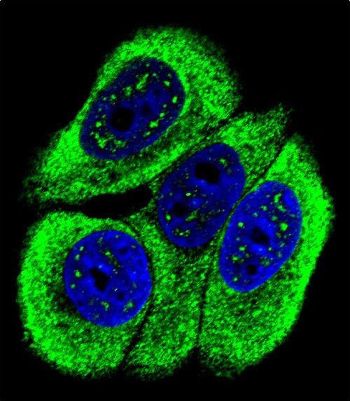 Confocal immunofluorescent analysis of Phospho-ABL1-Y251 Antibody(Cat#AP3014a) with MCF-7 cell followed by Alexa Fluor 488-conjugated goat anti-rabbit lgG (green). DAPI was used to stain the cell nuclear (blue).