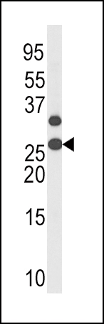 WB - Phospho-p27Kip1(T187) Antibody AP3194a