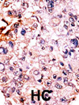 IHC-P - Phospho-p27Kip1(T187) Antibody AP3194a