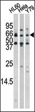 WB - Phospho-RAD9(S272) Antibody AP3223a