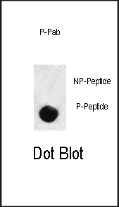 DB - Phospho-SMAD3(S208) Antibody AP3249a