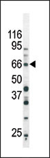 WB - Phospho-SMAD3(S213) Antibody AP3250a