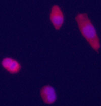 Immunofluorecence staining of anti-GPC3 Pab (cat# AP6339c) on HepG2 cells. The cells were acetone fixated. Antibody dilution of 1:50. Original magnification 1:400. Data and protocol courtesy of Dr. Mariana Dabeva, Department of Medicine at Albert Einstein College of Medicine.