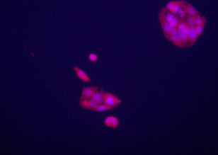 Immunofluorecence staining of anti-GPC3 Pab (cat# AP6340d) on HepG2 cells. The cells were acetone fixated. Antibody dilution of 1:50. Original magnification 1:400. Data and protocol courtesy of  Dr. Mariana Dabeva, Department of Medicine at Albert Einstein College of Medicine.