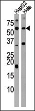 Western blot analysis of anti-ACVR1C Antibody (N-term A48) (Cat.#AP7102a) in HepG2 and Hela cell line lysate (35ug/lane). ACVR1C (arrow) was detected using the purified Pab.