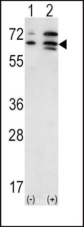 Western blot analysis of ACVR2A (arrow) using rabbit polyclonal ACVR2A Antibody (N-term) (Cat.#AP7103a). 293 cell lysates (2 ug/lane) either nontransfected (Lane 1) or transiently transfected with the ACVR2A gene (Lane 2) (Origene Technologies).