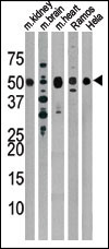 The anti-Drosophila Parkin Pab (Cat. #AP6414a) is used in Western blot to detect Drosophila Parkin in, from left to right, mouse kidney, mouse brain, mouse heart, Ramos, and Hela tissue lysates.