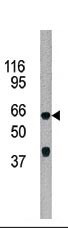 WB - ADCK5 Antibody (C-term) AP7108b