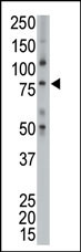 The anti-p100 Pab (Cat. #AP2044a) is used in Western blot to detect p100 in placenta lysate.