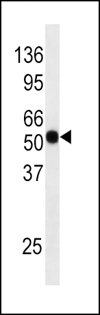 WB - Phospho-CDC25A(S124) Antibody AP3045a