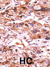 IHC-P - Phospho-CDC25A(S124) Antibody AP3045a