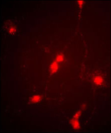 Immunofluorescence image of cultured chick retinal amacrine (neuronal) cells labeled with CLC4 Antibody (C-term) (Cat # AP6329f).   Data courtesy of Emily McMains, Louisiana State University.