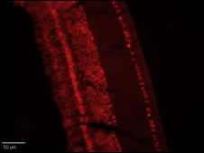 IHC-P-Leica - CLC4 Antibody (C-term) AP6329f