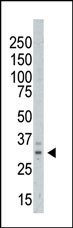 The anti-AURKC Pab (Cat. #AP7000b) is used in Western blot to detect AURKC in A375 cell  lysate