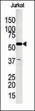 The anti-GKP2 Pab (Cat. #AP7131b) is used in Western blot to detect GKP2 in Jurkat tissue lysate