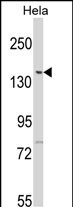 Western blot analysis of LTK2 N-term (Cat. #AP7140a) in Hela cell line lysates (35ug/lane). LTK2 (arrow) was detected using the purified Pab.